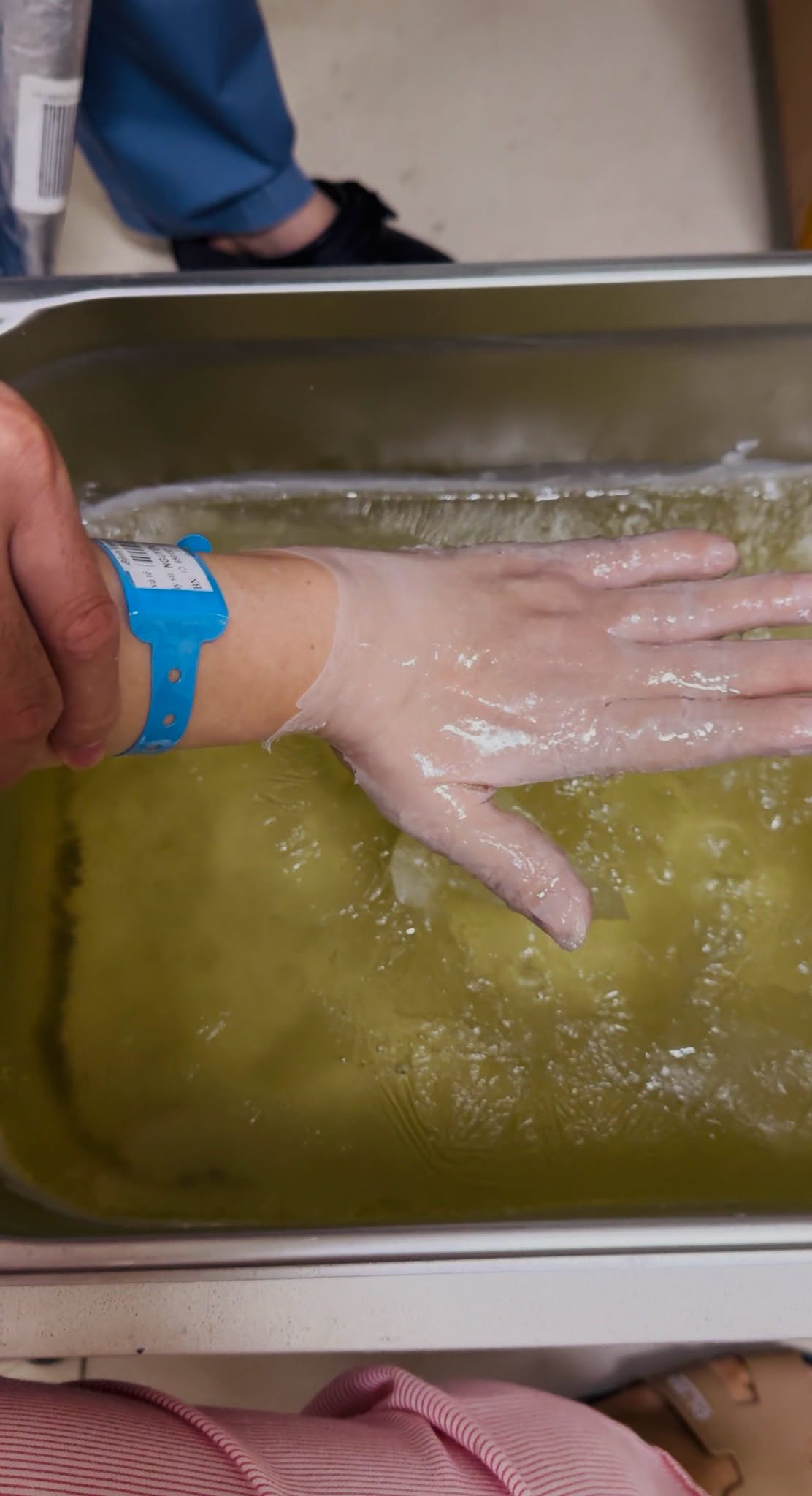 Sáp Paraffin: Giải pháp giảm đau, cải thiện vận động